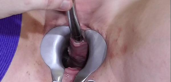  Analslut Multiple Sounds - James is stretching her urethra with multiple sounds - peeing into her gaping cunt